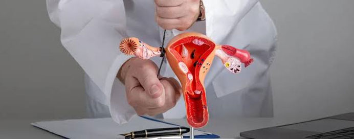 PCOS Management